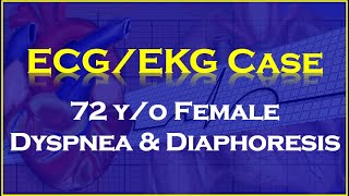 ECGEKG Case 72 Year Old Female Dyspnea and Diaphoresis [upl. by Shauna]