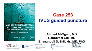 Case 253 Manual of CTO PCI  IVUS guided puncture [upl. by Medrek]