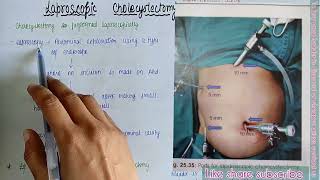 CARE PLAN ACUTE CHOLECYSTITIS [upl. by Meghan]