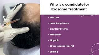 Exosome Treatment l Hair Loss l Balding l Hair Fall l Twacha l Dwarka l Delhi [upl. by Yllib283]