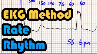 Method Rate Rhythm How to Read an EKG Curriculum [upl. by Kirit131]