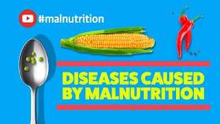 Diseases Caused by Malnutrition  SCURVY RICKETS BERIBERI PELLAGRA [upl. by Mitzl972]