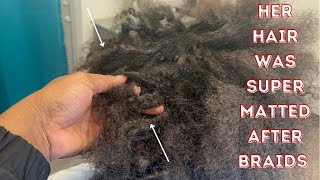 Her hair locd after removing braids  How to detangle tangled hair  Matted hair from braids [upl. by Sink]