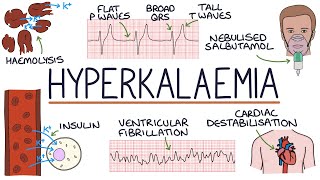 Understanding Hyperkalaemia High Potassium [upl. by Wulf539]