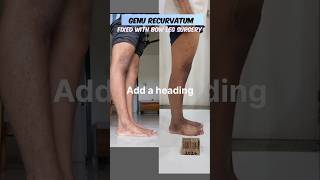 Genu recurvatum correction in Mumbai genurecurvatum bowlegs [upl. by Oirom]