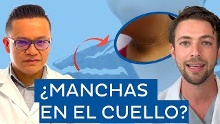 ¿MANCHAS en el CUELLO o las AXILAS  Diabetes y acantosis nígricans [upl. by Bashemeth]