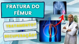 FRATURA DE FÊMUR COMO É A CIRURGIA E RECUPERAÇÃO [upl. by Otrebile]