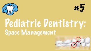 Pediatric Dentistry  Space Management  INBDE ADAT [upl. by Laamaj599]