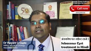 अंडकोष पर फोड़े फुंसी  अंडकोष के बालतोड़  Sebaceous Cyst Scrotum treatment in Hindi [upl. by Noxid]