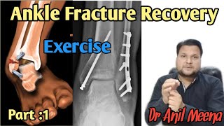 Ankle Fracture recovery  Ankle Fracture healing Process  Ankle Fracture Exercise  In Hindi [upl. by Ecirted]