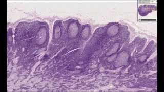 Histologia Humana  Linfonodo [upl. by Aseen]