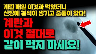 계란 이것과 먹었다가 신장에 돌이 생기고 중풍이 오고 말았습니다 달걀 이렇게 먹고 계셨다면 그동안 독을 먹었던겁니다 계란과 절대 같이 먹으면 안되는 음식 신장결석 유발 [upl. by Simonette100]