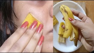 i rubbed Banana Peel on my face amp my Pimples are gone Banana Face Mask [upl. by Donella]