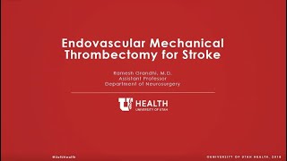 How Mechanical Thrombectomy Saves Stroke Patients Shorts [upl. by Rock]