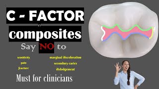 C Factor in dental composites [upl. by Kylen]