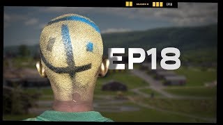 Bad Hair Day  EP18  Camp Woodward Season 9 [upl. by Haiel]