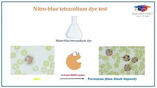 Nitroblue Tetrazolium test  NEETMDS  INICET AcetheNEET [upl. by Abih367]