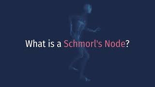 What is a Schmorls Node Schmorls Node Definition [upl. by Anaylil]