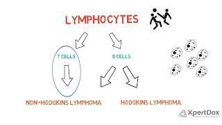 T Cell Lymphoma [upl. by Laughton49]