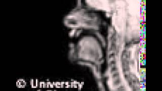 Voiceless uvular plosive MRI [upl. by Alaj]