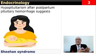 USMLE Step 2  Endocrinology 1 Flash Card Review [upl. by Nnayram]