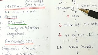 Mitral Stenosis MS Valvular Heart Disease General Medicine [upl. by Reba16]