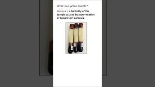 Lipemic Sample laboratory medicallaboratorytechnician shortsvideo [upl. by Conard]