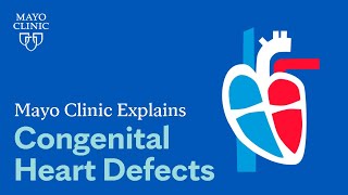 Mayo Clinic Explains Congenital Heart Defects [upl. by Cord]