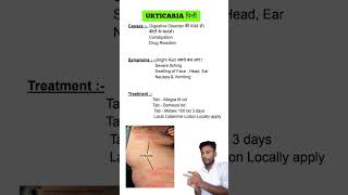 Urticaria  पित्ती causes symptoms and treatment [upl. by Aileduab357]