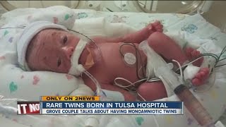 Very rare monoamniotic quotMoMoquot twins born to Tulsa couple [upl. by Kram]