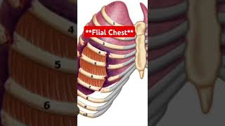 Flail chest  Paradoxical movement  nursing image based  Ribs fracture [upl. by Suiraj]