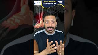 Ankle–brachial pressure index  ABPI  Aspire Education  PLAB2 [upl. by Ruperto]