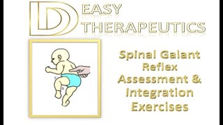 Spinal Galant Reflex Its Significance Assessment and Exercises  Primitive Reflexes [upl. by Sheng]