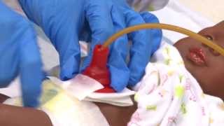 Caring for My Child with a Gastrostomy Tube  St Louis Childrens Hospital [upl. by Primalia]