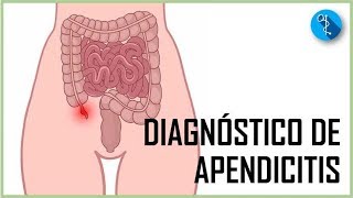 DIAGNÓSTICO DE APENDICITIS AGUDA  Aprendiendo Medicina MEDX [upl. by Prouty726]