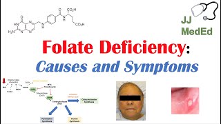 Folate Deficiency Causes ex medications Pathogenesis Symptoms Diagnosis and Treatment [upl. by Lugo754]