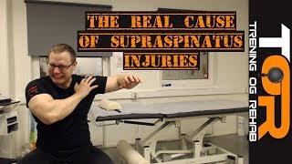 The real cause of supraspinatus injuries [upl. by Nytsyrk921]