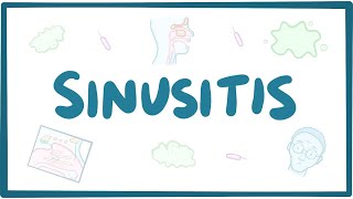 Sinusitis  causes symptoms diagnosis treatment pathology [upl. by Starobin183]