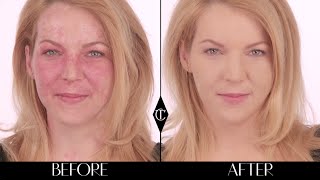 How to cover up birthmarks Charlotte Tilbury Magic Foundation Makeup Tutorials [upl. by Enyleve980]