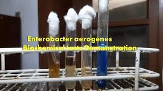 Enterobacter aerogenes Biochemical tests Demonstration [upl. by Gelman]