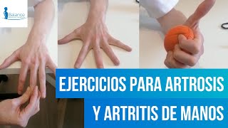 Anatomia y huesos de la mano fracturas mas frecuentes [upl. by Zampardi]