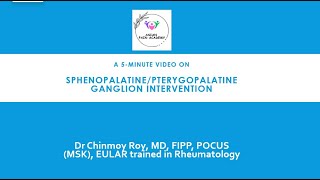 5Minute Video sphenopalatine ganglion block [upl. by Aidni]