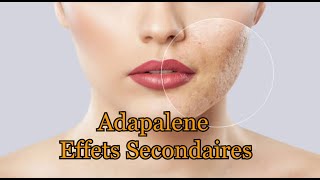 Adapalene Effets secondaires [upl. by Aisela788]