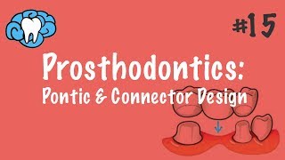 Prosthodontics  Pontic amp Connector Design  INBDE ADAT [upl. by Thoer]