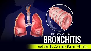 Bronchitis  Acute Bronchitis [upl. by Blau]