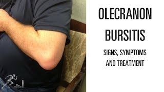 Olecranon bursitis Signs symptoms and treatment of the elbow problem [upl. by Klara]