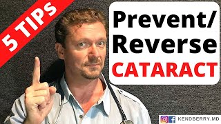 PreventReverse CATARACTS with These 5 Tips [upl. by Aihsyn]