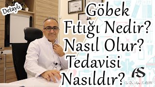 Göbek Fıtığı Nedir Nasıl Olur ve Tedavisi Nasıl Yapılır Op Dr Aytaç Sayın [upl. by Amrak]