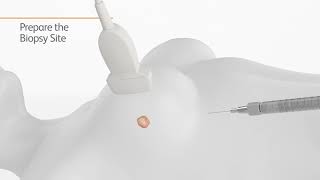 BD EleVation Breast Biopsy Instructional Video [upl. by Eiknarf]