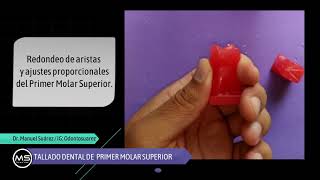 Tallado Dental UD Primer Molar Superior En Taco de cera [upl. by Nicolas]